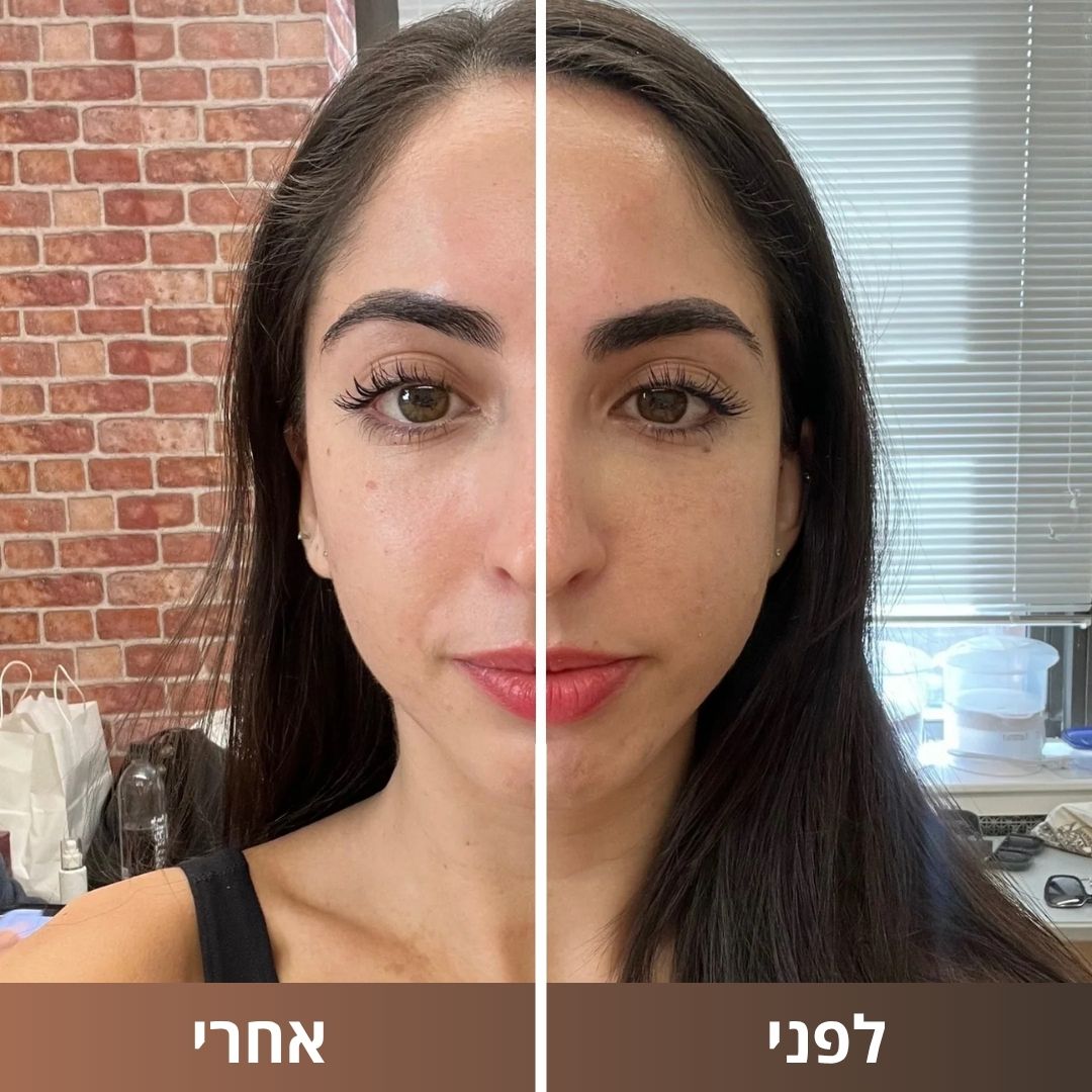 מברשת עיסוי לימפטי PureGlow